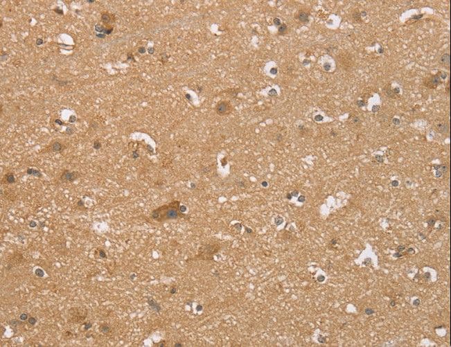 RNF148 Antibody