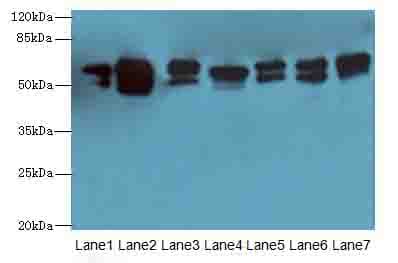Polyclonal Rabbit anti-Human ATL2 Antibody (IHC, WB)