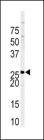 IHC-plus™ Polyclonal Rabbit anti-Human Sprouty 4 / SPRY4 Antibody (aa270-301, IHC, WB)