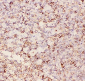 SPN / CD43 Antibody