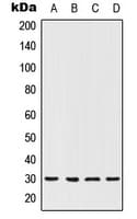 HOXC12 Antibody (Internal)