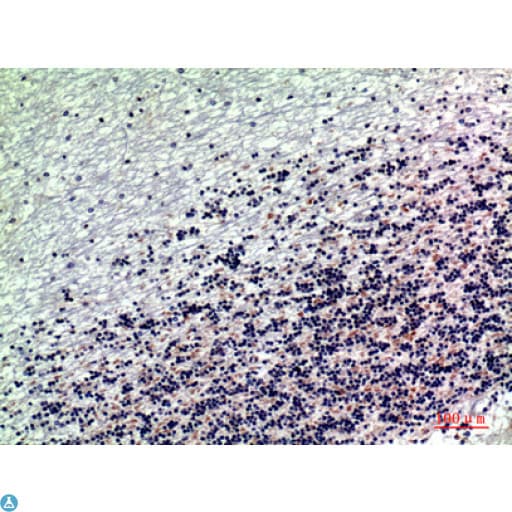 DROSHA / RNASEN Antibody