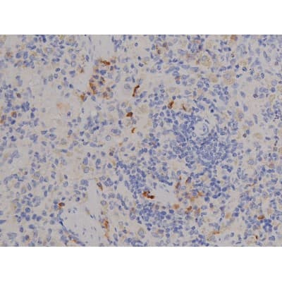 STAT6 Antibody (phospho-Tyr641)
