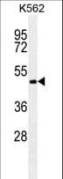 Monoclonal Mouse anti-Human RNF8 Antibody (WB)