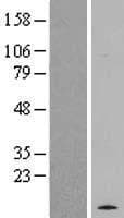 RRP22 / RASL10A Protein (Over-Expression Lysate Myc-DDK (Flag))