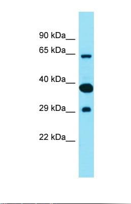 FAM83D Antibody (aa334-383)