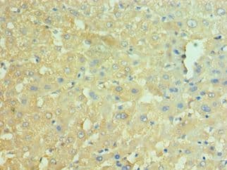 Polyclonal Rabbit anti-Human NAMPT / Visfatin Antibody (aa1-280, IHC)