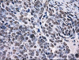 RPA2 / RFA2 / RPA34 Antibody (clone OTI7C12)
