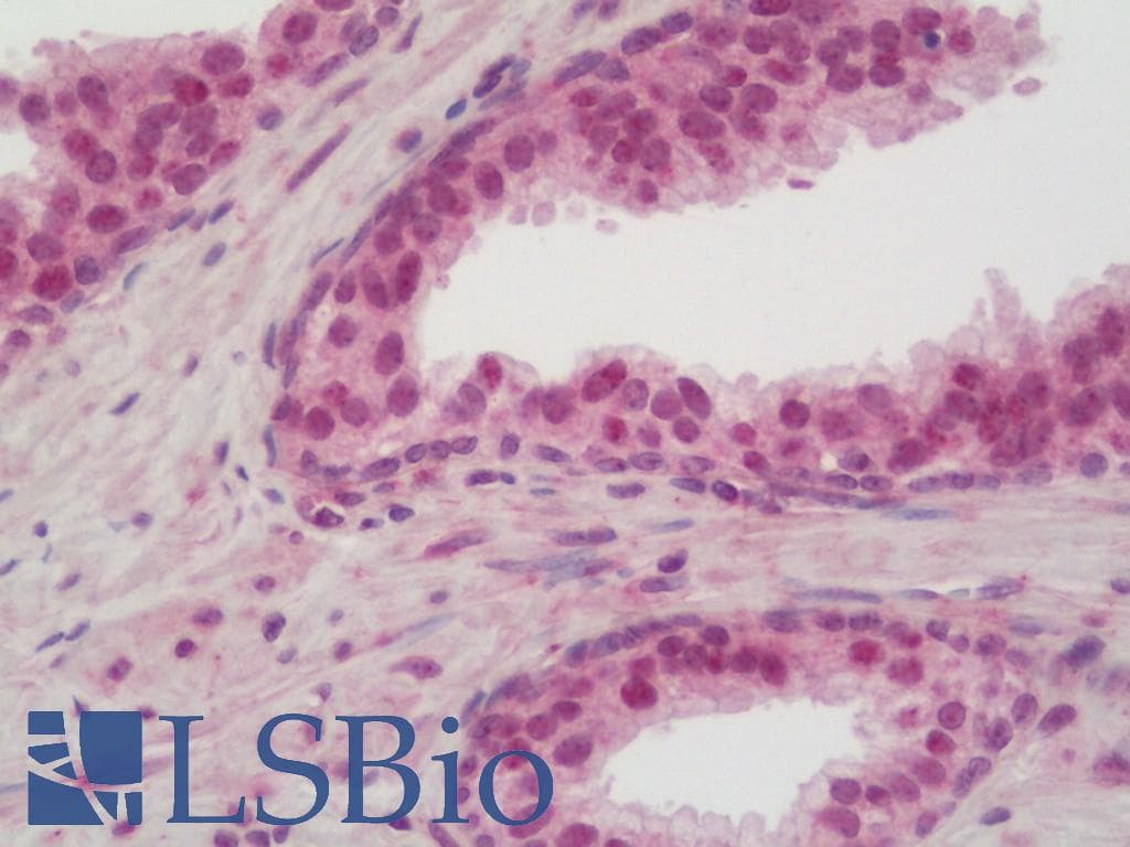 Yo / CDR2 Antibody (HRP)