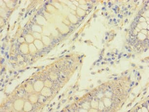 MACROD1 / LRP16 Antibody