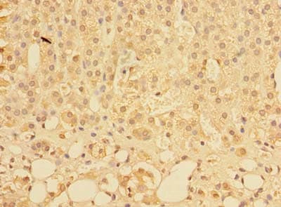 PLEKHS1 / C10orf81 Antibody