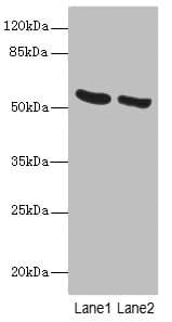 PNPLA2 / ATGL Antibody
