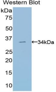 SUV420H2 Antibody (aa2-279)