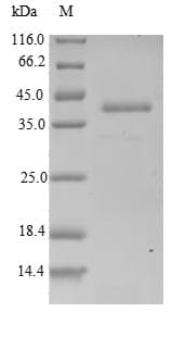 Human ARPC5 / p16-Arc Protein (Recombinant GST, N-terminus)
