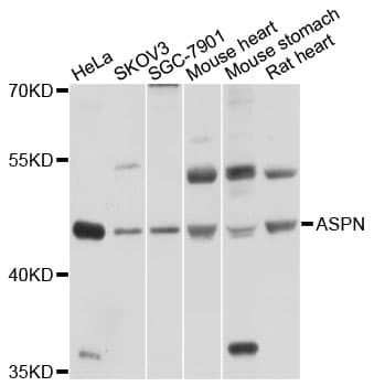 Polyclonal Rabbit anti-Human ASPN / Asporin Antibody (WB)
