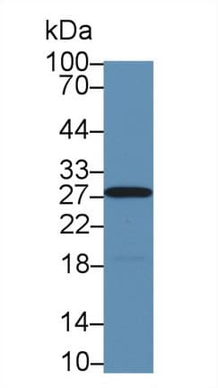 Polyclonal Rabbit anti-Monkey CA2 / Carbonic Anhydrase II Antibody (aa1-260, WB)