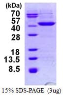 Human HIBCH Protein (Recombinant His)