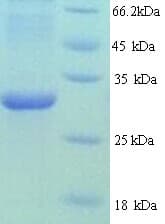 Human HNRNPL / hnRNP L Protein (Recombinant His)