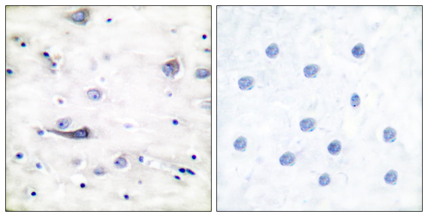 GRIA1 / GLUR1 Antibody (phospho-Ser863)