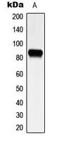 Polyclonal Rabbit anti-Human PIK3R1 / p85 Alpha Antibody (Internal, IHC, WB)