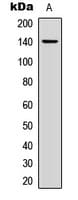 Polyclonal Rabbit anti-Human COL2A1 / Collagen II Alpha 1 Antibody (N-Terminus, IHC, WB)