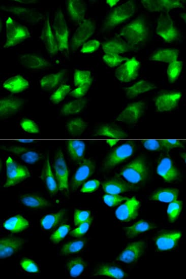 ARHGDIA / RHOGDI Antibody
