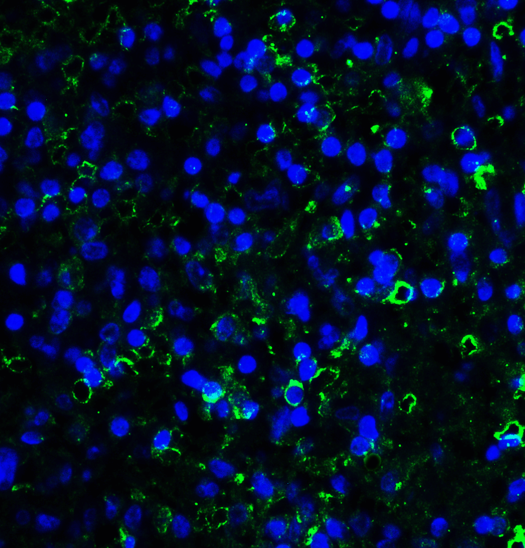 Monoclonal Mouse anti-Human LAG3 Antibody (clone 5F11, IHC, IF, WB)