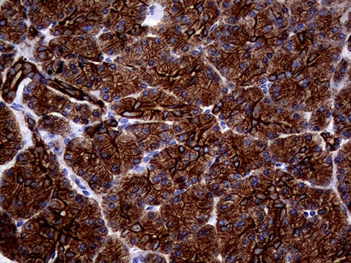 KRT18 / CK18 / Cytokeratin 18 Antibody (aa69-372, clone OTI10H8)