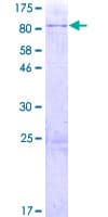Human MBTPS1 / S1P Protein (Recombinant GST, N-terminus)