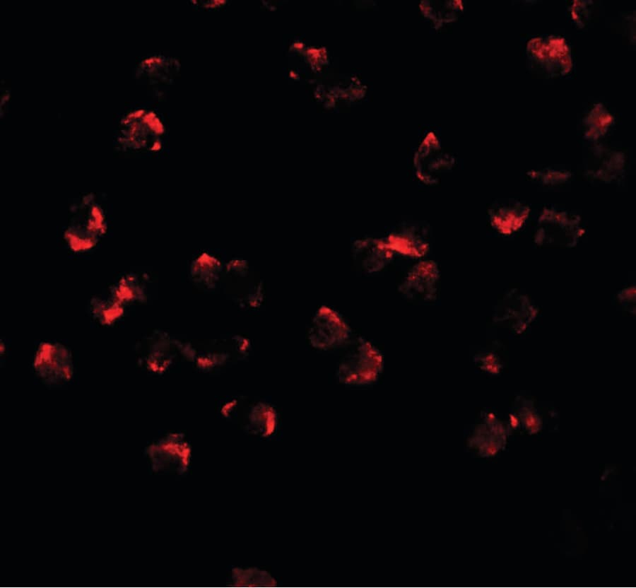 IHC-plus™ Polyclonal Rabbit anti-Human PHF14 Antibody (IHC, IF, WB)