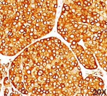 Tyrosinase Antibody (clone T311, Ready-to-Use)