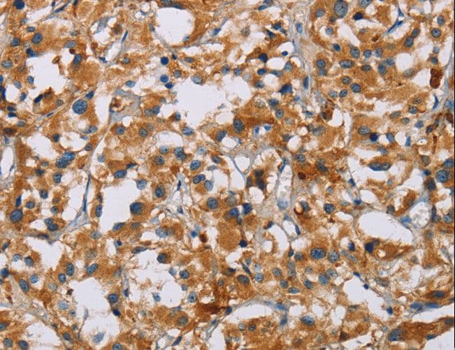 Polyclonal Rabbit anti-Human NRN1 / Neuritin Antibody (IHC)
