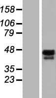 SS18 Protein (Over-Expression Lysate Myc-DDK (Flag))