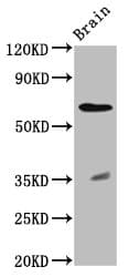 PathPlus™ RPE65 Antibody