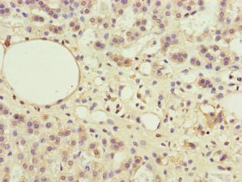 Polyclonal Rabbit anti-Human PPP2R3B Antibody (IHC, WB)
