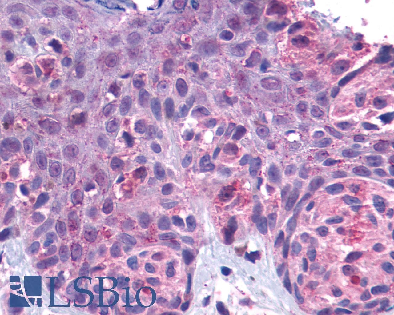 PathPlus™ GPR162 Antibody (Extracellular Domain)