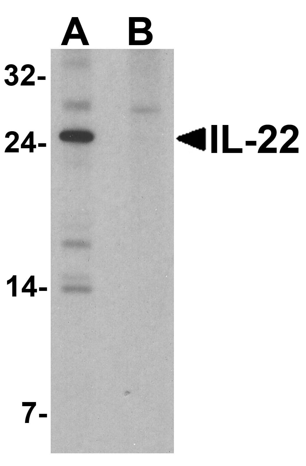 IL22 Antibody