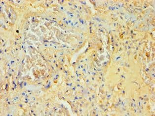 Polyclonal Rabbit anti-Human SOCS2 Antibody (aa1-198, IHC, WB)