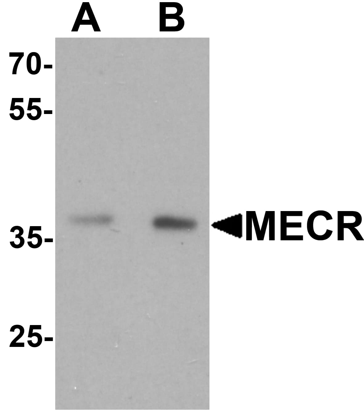 IHC-plus™ Polyclonal Rabbit anti-Human MECR Antibody (IHC, WB)