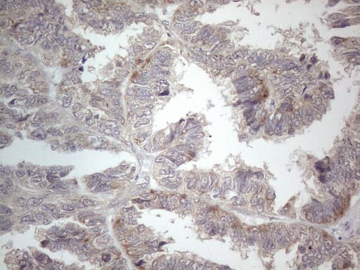 Monoclonal Mouse anti-Human PD-L2 / PDCD1LG2 / CD273 Antibody (clone OTI5E5, IHC, WB)