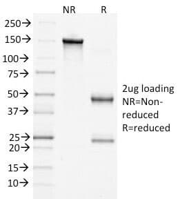 Monoclonal Mouse anti-Human CTNNB1 / Beta Catenin Antibody (clone 15B8, IHC, IF, WB)