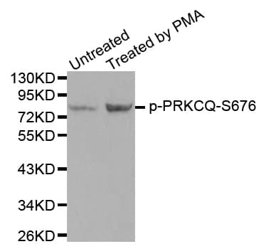 PRKCQ / PKC-Theta Antibody (phospho-Ser676)
