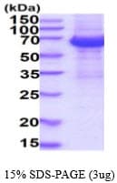 Human IL12RB1 / CD212 Protein (Recombinant His)