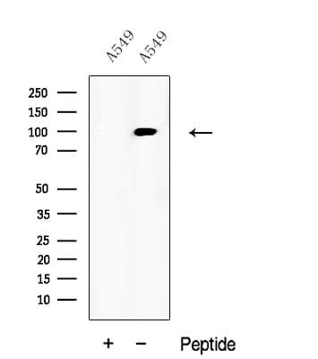 USP5 Antibody