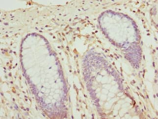 Polyclonal Rabbit anti-Human OPHN1 Antibody (IHC, WB)