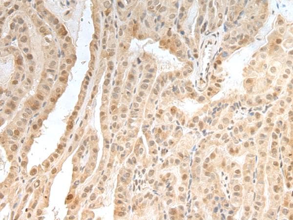 ZNF191 / ZNF24 Antibody