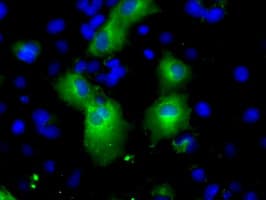 PDE4A / PDE4 Antibody (clone OTI6B6)