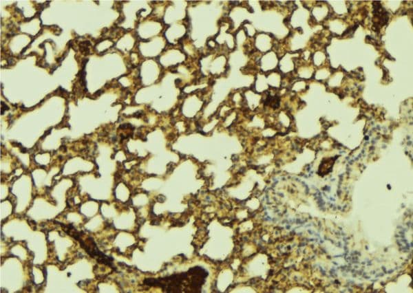 PPHLN1 Antibody