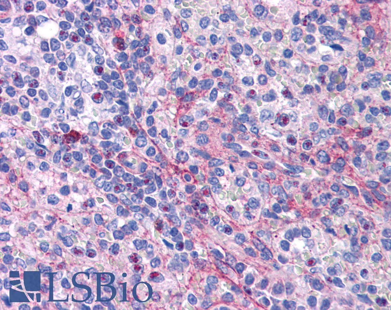 IHC-plus™ EIF5A Antibody (aa13-27)