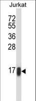RHOC Antibody (aa102-130)